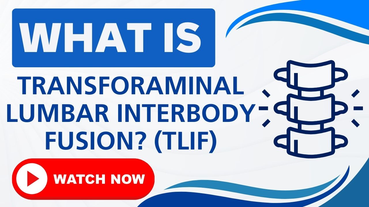 Transforaminal Lumbar Interbody Fusion (TLIF)