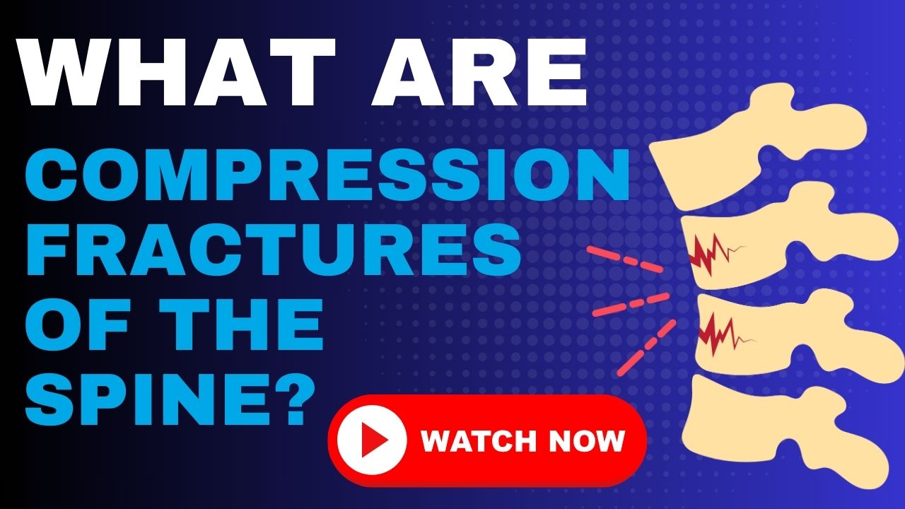 Compression Fracture