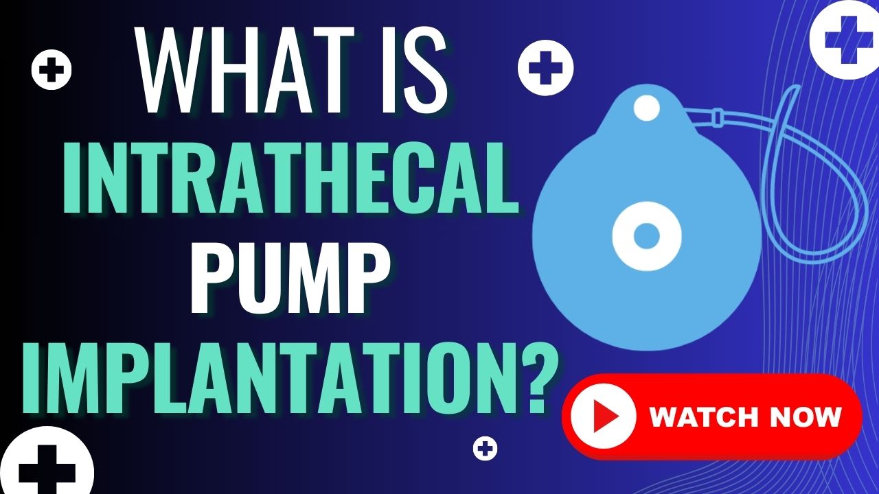 Intrathecal Pump